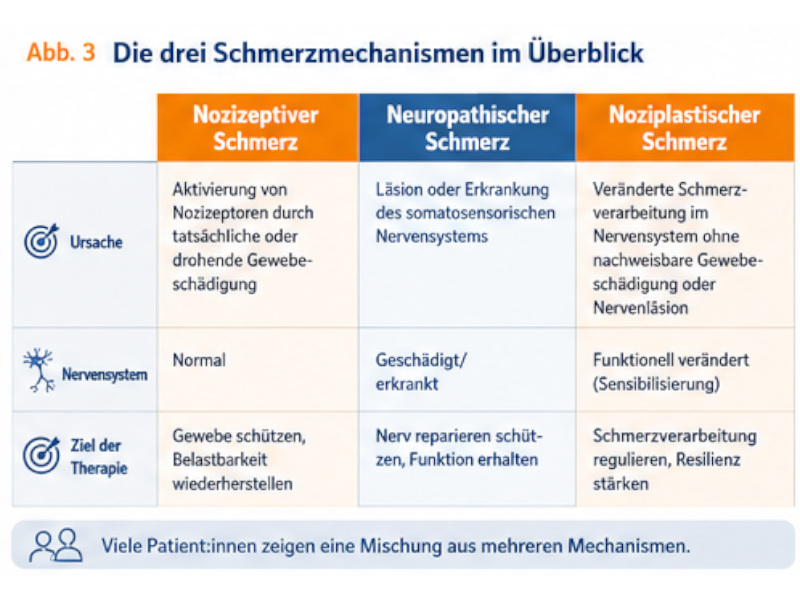 schmerzmechanismus Übersicht zu nozizeptivem, neuropathischem und noziplastischem Schmerz mit Ursachen, Nervensystem und Therapiezielen