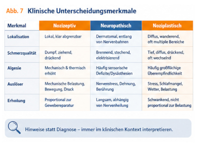 unterscheidungsmerkmale Tabelle vergleicht nozizeptive, neuropathische und noziplastische Schmerzen nach Ort, Qualität, Auslösern und Erholung.